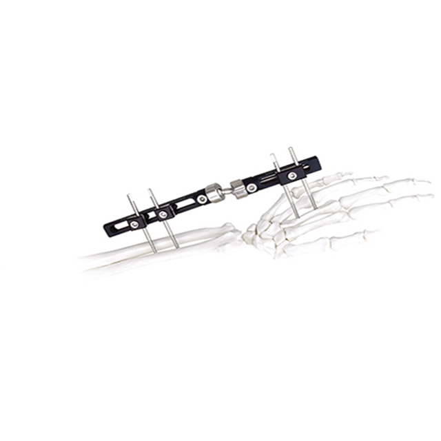 China Single pin Type Orthofix External Fixator manufacturers, Single